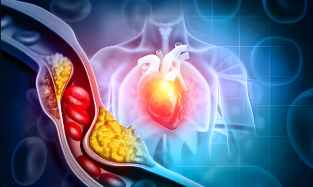 Các cách giúp giảm cholesterol có thể làm ngay tại nhà